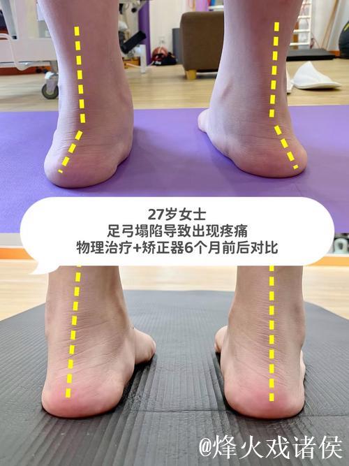 加福德：右脚踝状况改善明显，这是我近期感觉最好的一次