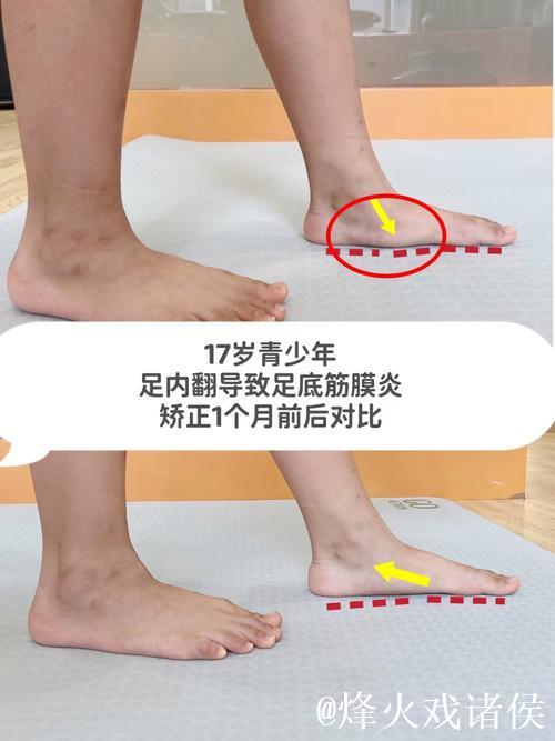 加福德：右脚踝状况改善明显，这是我近期感觉最好的一次